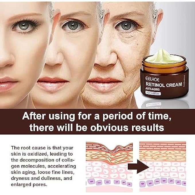 EELHOE RETINOL ANTI AGING WRINKLE REMOVAL SKIN FIRMING CREAM, EELHOE RETINOL CREAM ANTI-AGING WITH HYALURONIC ACID AND VITAMIN (5PCS) - Image 4